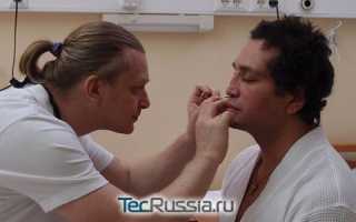 Рустам Солнцев до и после пластики. Фото, какие операции перенёс, как выглядит сейчас